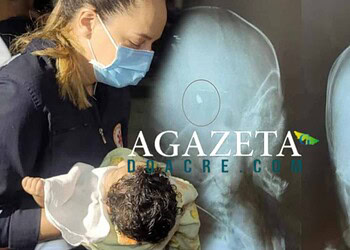 Bebê alvejado com tiro na Cidade do Povo continua com bala alojada na cabeça e internado em UTI