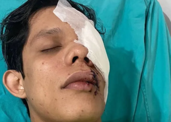 O jovem corre risco de perder a visão (Foto: Cedida)