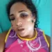 Família faz campanha para custear cirurgia de acreana atingida com tiro na cabeça pelo marido