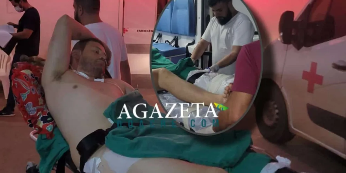 Trabalhador sofre acidente de moto e corre risco de perder a perna