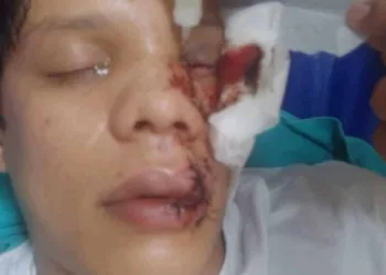 MPAC acompanha investigações sobre agressão de jovem que perdeu a visão ao ser atingido com copo