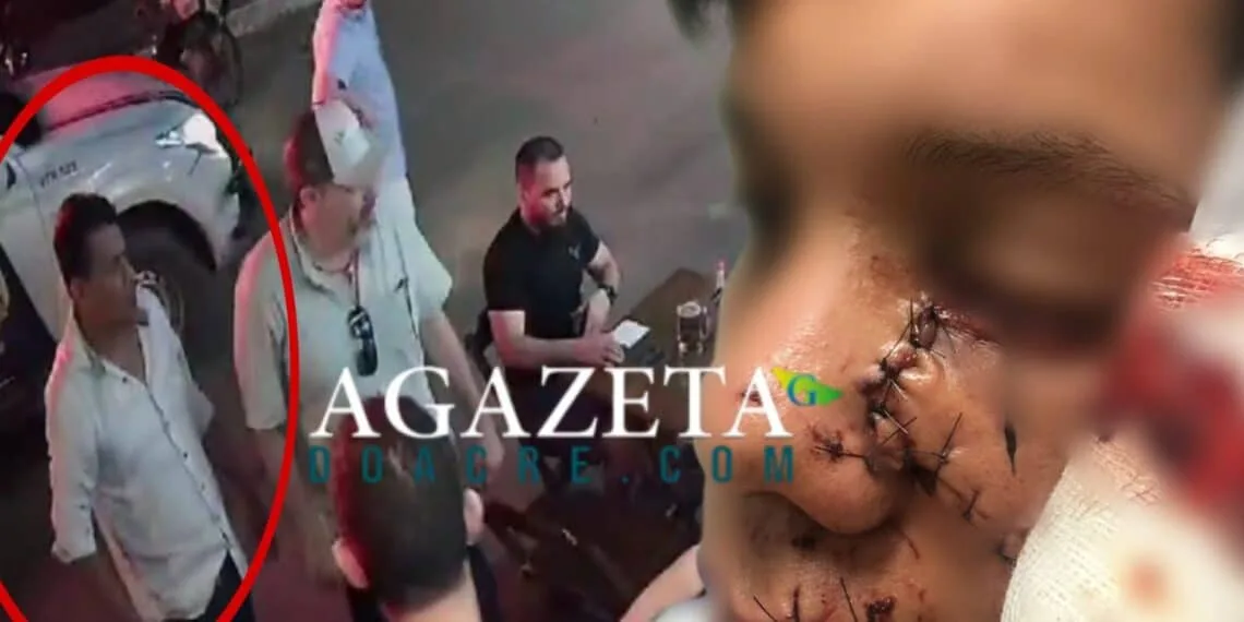MPAC recorrerá da decisão que negou prisão preventiva de empresário que agrediu jovem em Brasileia