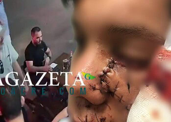 MPAC recorrerá da decisão que negou prisão preventiva de empresário que agrediu jovem em Brasileia