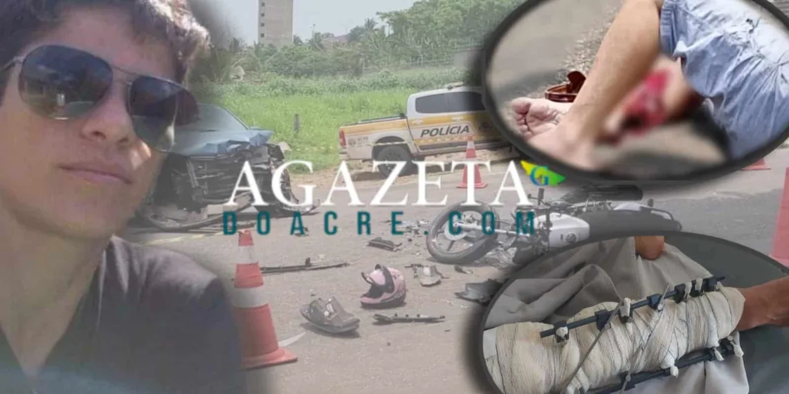 Após 5 horas de cirurgia, médicos conseguem salvar perna de mulher acidentada no AC