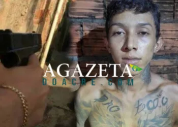 Jovem baleado em tiroteio entre facções perde a visão dos dois olhos