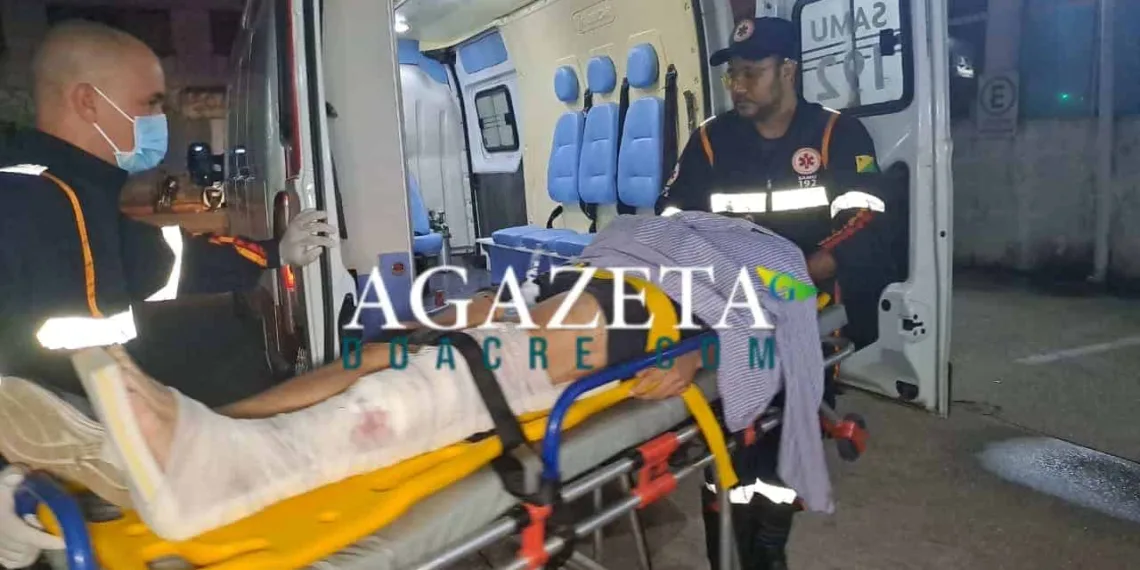 Motociclista tem perna dilacerada em acidente de trânsito na capital acreana