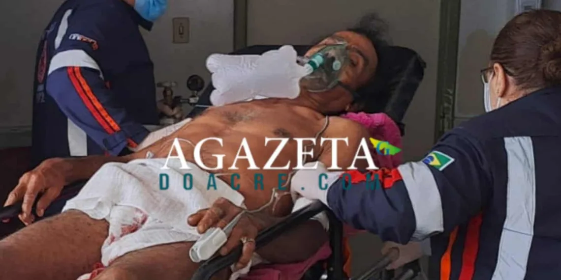 Idoso cai sobre terçado, sofre corte na barriga e tem vísceras expostas