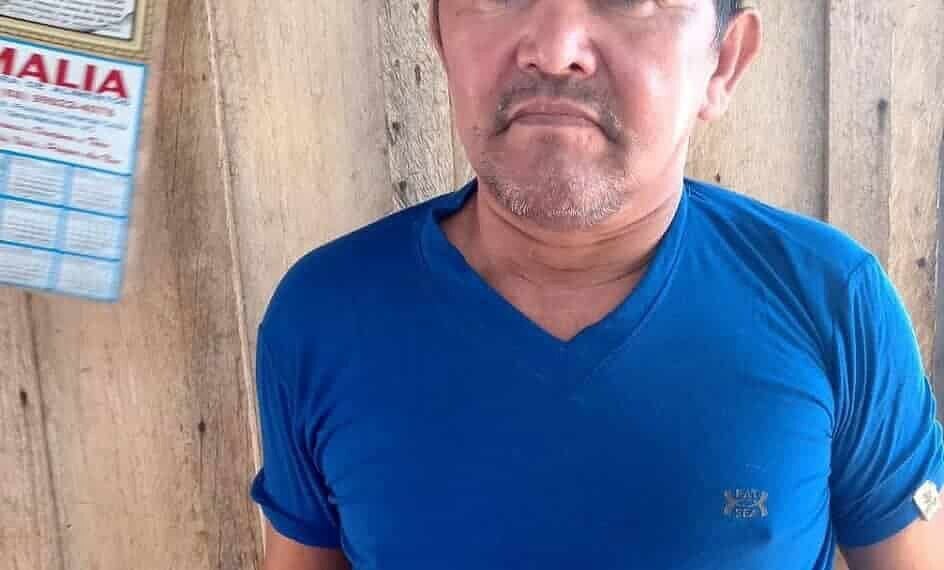 Acreano sofre AVC, fica com sequelas e mãe pede ajuda para custear cirurgia