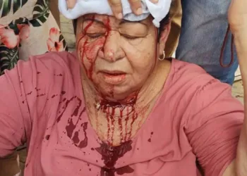 Idosa sofre ferimento na cabeça após cair em buraco na Benjamin Constant, Centro da Capital