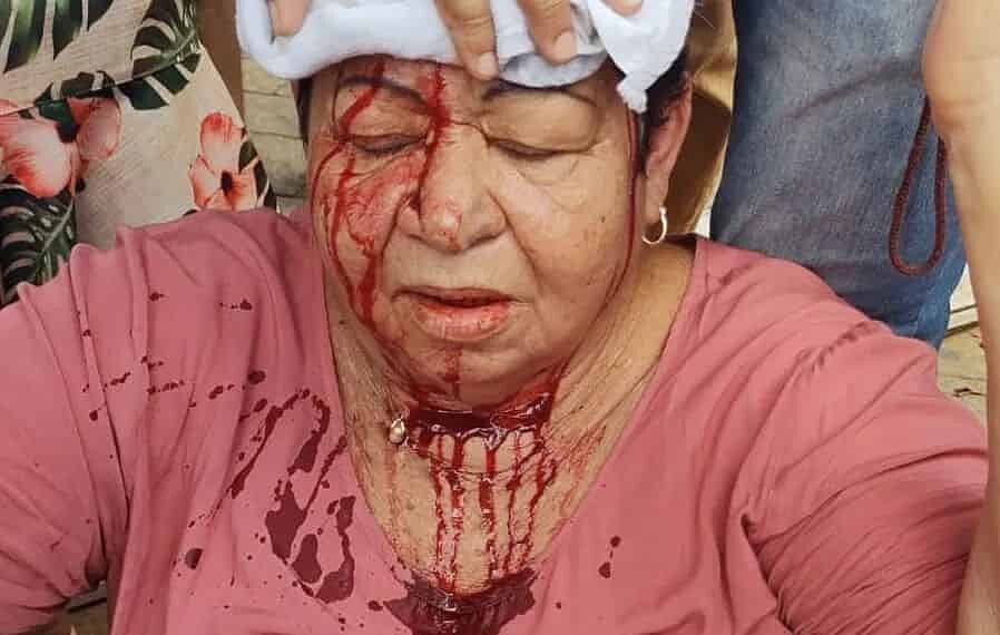 Idosa sofre ferimento na cabeça após cair em buraco na Benjamin Constant, Centro da Capital