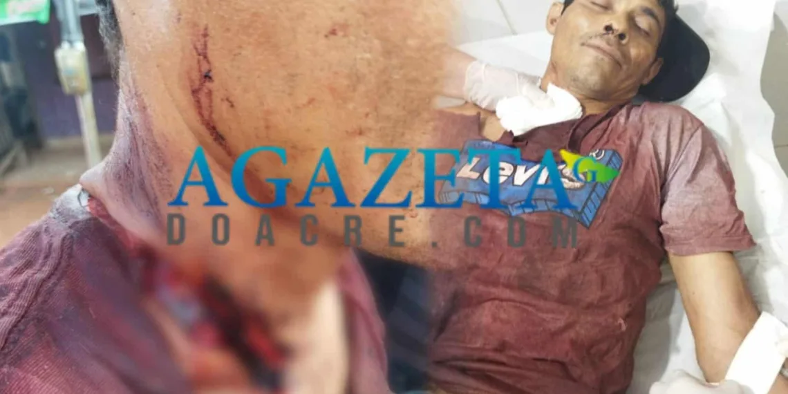 'Amigos' se desentendem durante bebedeira e trocam golpes de faca
