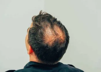 Novo remédio contra queda de cabelo é aprovado pela Anvisa