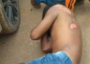 Motorista faz conversão proibida e atinge motocicleta; duas pessoas ficam feridas