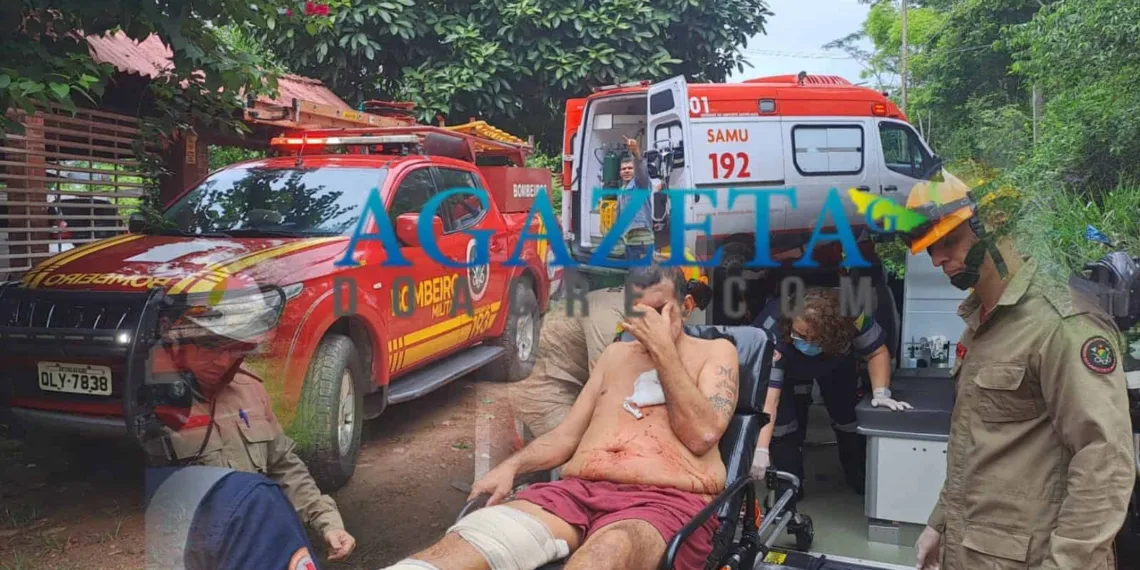 Homem sofre acidente doméstico com uma faca de serra e é salvo por bombeiros
