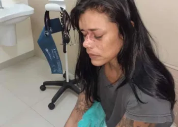 Após término de namoro, mulher é agredida a socos em via pública pelo ex