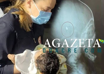 Bebê de 4 meses alvejado com tiro na cabeça morre em hospital de Rio Branco