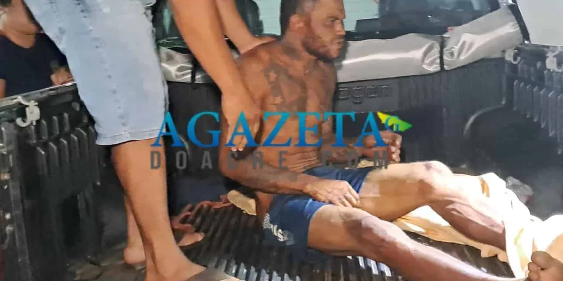 Conhecido por ser o 'valentão do bairro', homem é violentamente agredido e sofre corte profundo na cabeça