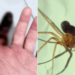 Homem picado por aranha venenosa enquanto dormia terá dedo amputado