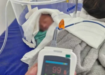 O bebê nasceu com apenas 33 semanas de gestação e se chama Luidy. Foto: cedida