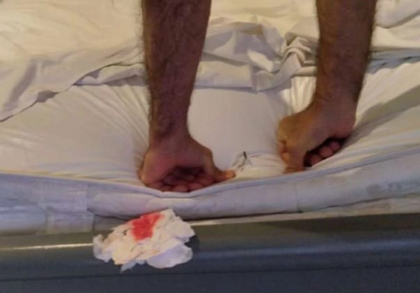 Motel é condenado a pagar cliente que furou joelho com prego na cama