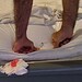 Motel é condenado a pagar cliente que furou joelho com prego na cama