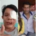 Justiça do Acre aceita denúncia e empresário que agrediu professor em bar vira réu; vítima perdeu olho