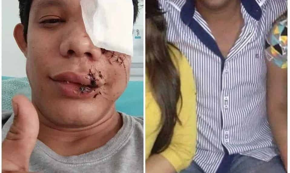 Justiça do Acre aceita denúncia e empresário que agrediu professor em bar vira réu; vítima perdeu olho