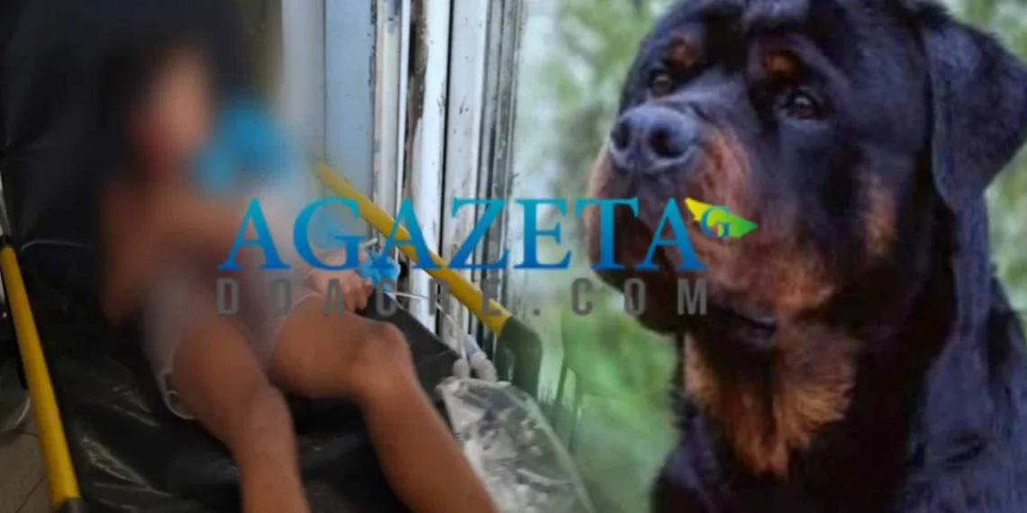 Criança de cinco anos é violentamente atacada por cão Rottweiler em Rio Branco