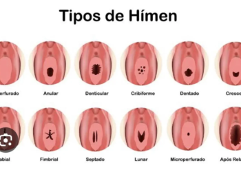 O hímen não é um lacre a ser rompido