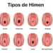 O hímen não é um lacre a ser rompido
