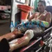Cachorro atravessa via e causa acidente com motocicleta na BR-364