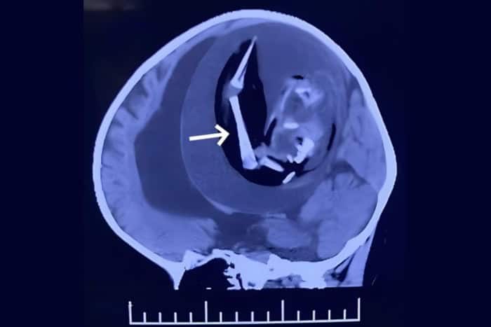 Reprodução/American Journal of Case Reports