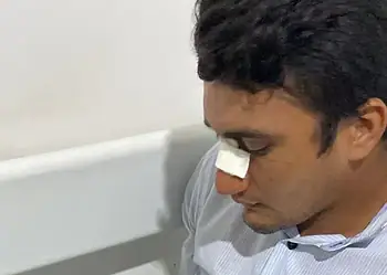 Motociclista fica ferido após ser atingido por linha com cerol em Rio Branco