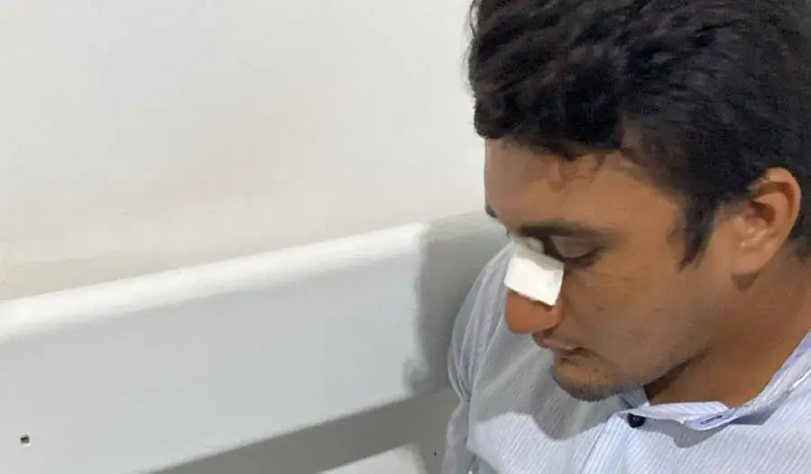 Motociclista fica ferido após ser atingido por linha com cerol em Rio Branco