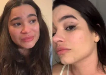 Acreana Raissa Barbosa expõe agressão do ex e hematomas: “Achei que ia morrer”
