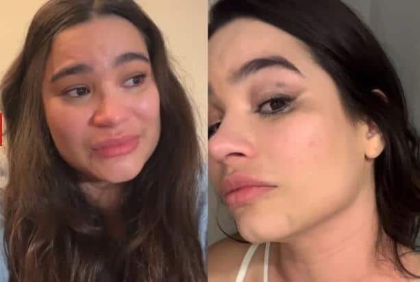 Acreana Raissa Barbosa expõe agressão do ex e hematomas: “Achei que ia morrer”