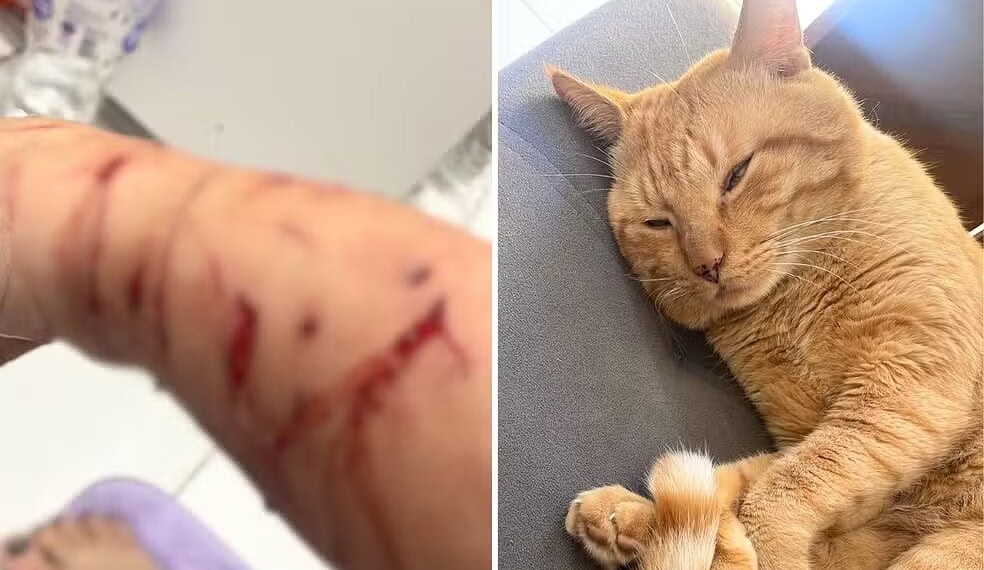 Tutora teve braços e pernas 'rasgados' durante 'ataque' do gato em casa — Foto: Arquivo Pessoal