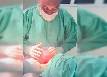 Médico faz parto de bebê empelicado no Acre; veja vídeo