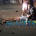 Adolescente em motocicleta colide contra caminhão e tem perda de memória