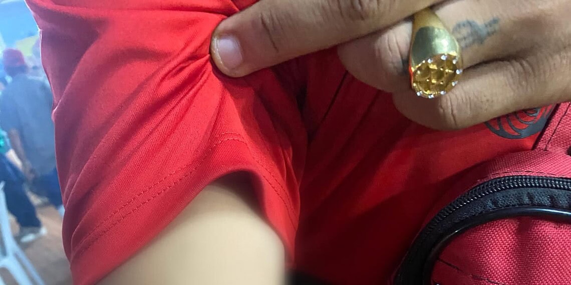 Homem sofre tentativa de homicídio na Expoacre 2024; suspeito foi reconhecido enquanto vítima recebia atendimento