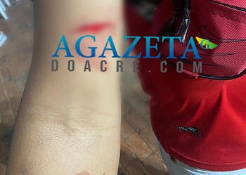 Homem sofre tentativa de homicídio na Expoacre 2024; suspeito foi reconhecido enquanto vítima recebia atendimento