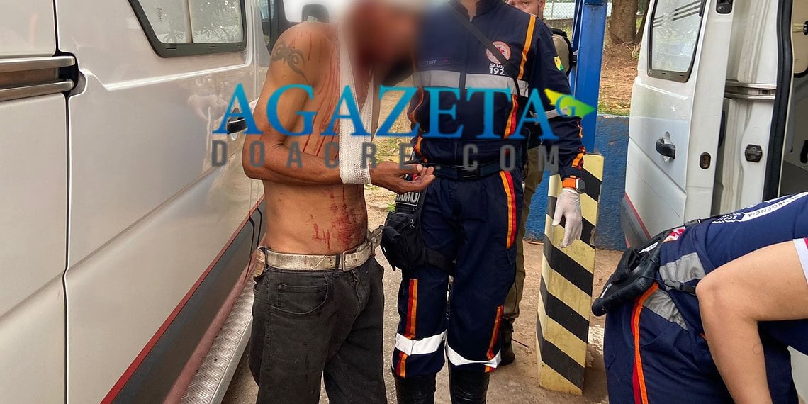 Por causa de cachorro, homem em situação de rua é espancado; vítima deve passar por cirurgia