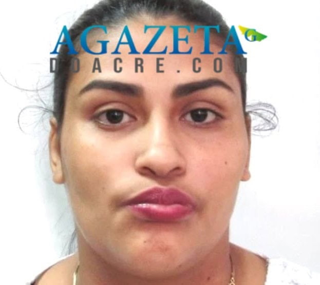 Jovem de 27 anos morre após cinco dias internada na UTI por conta de acidente de trânsito