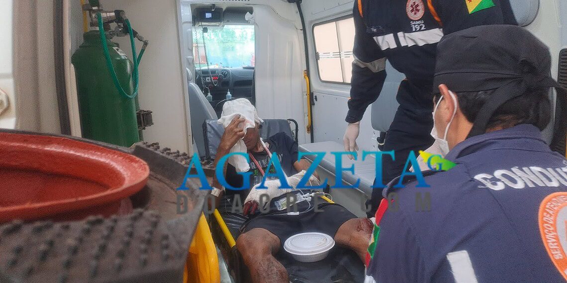 Homem em situação de rua tem parte da cabeça dilacerada como forma de 'disciplina'