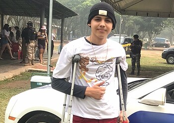 Adolescente cruzeirense tem perna amputada devido a câncer raro e família faz apelo: 'precisamos de ajuda'