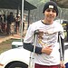 Adolescente cruzeirense tem perna amputada devido a câncer raro e família faz apelo: 'precisamos de ajuda'