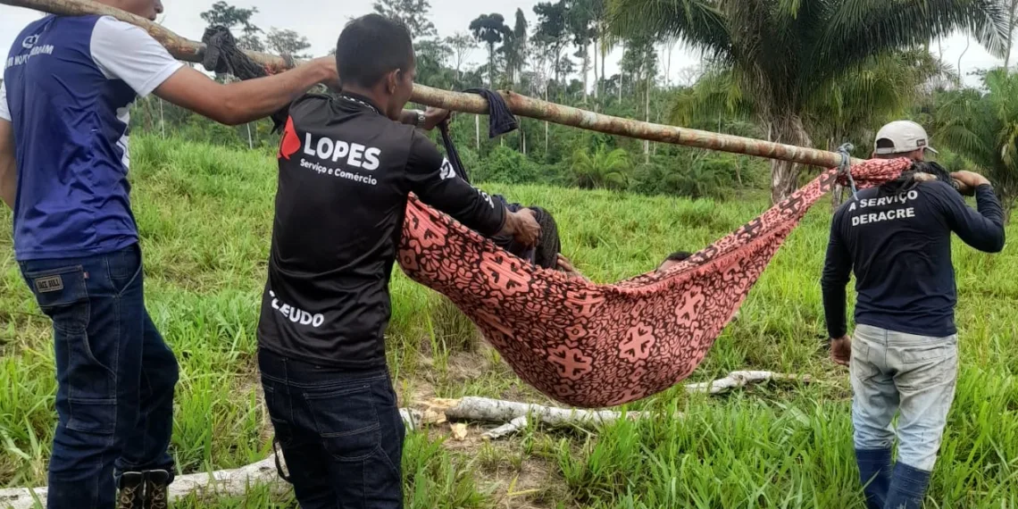 Homem quase tem perna esmagada por tronco durante derrubada no interior do Acre