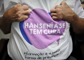 Foto: Odair Leal
