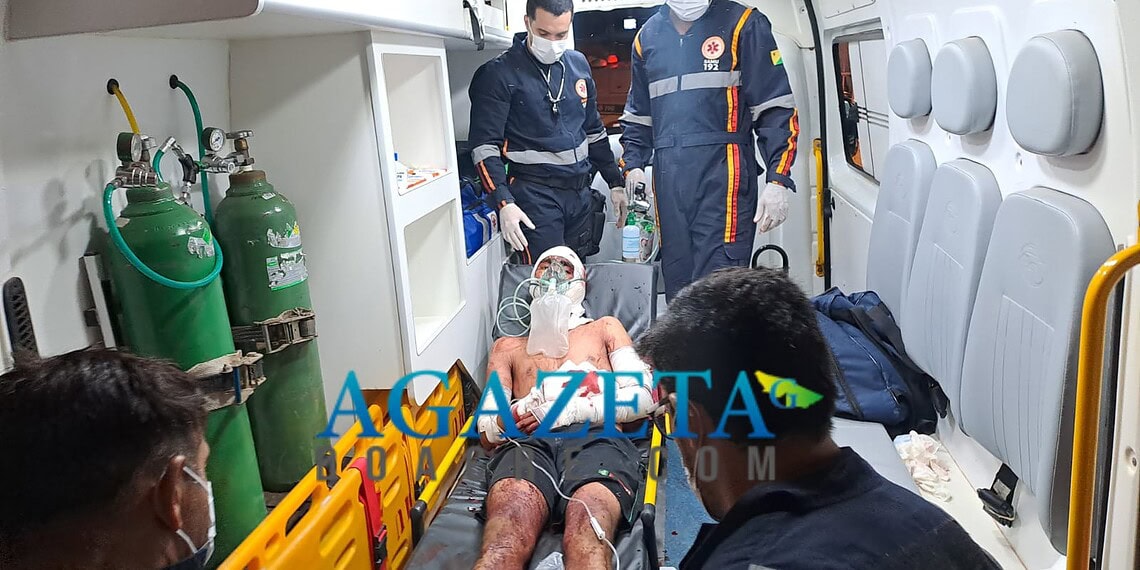 Jovem é agredido com golpes de terçado em invasão de Rio Branco e corre risco de perder a mão