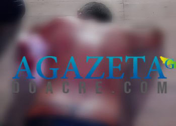 Comerciante é atacado com terçado ao fechar bar em Porto Acre; suspeitos estão foragidos